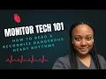 Monitor Tech Training How To Read Recognize Heart Rhythms