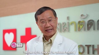 สาเหตุหลักของมะเร็งปอดคืออะไร และมีปัจจัยอื่นใดที่เพิ่มความเสี่ยงด้วย