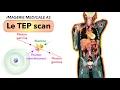 IMAGERIE MEDICALE Le TEP scan