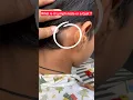 What s it Lymph Node or Cyst