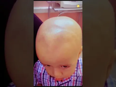 Is Naram Gadde Ko Galti Se bhi Mat Dabana