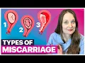 10 Kinds of Miscarriages Understanding the Difference and Why It Matters