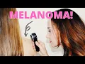 How to Spot a Melanoma at Home Healthy Skin Habits Dr Bartos Dermatology