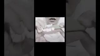                                                                                                      دندنها