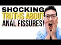 You NEED to know the TRUTH about Anal Fissures