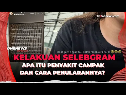 Viral! Selebgram Tetap Keluyuran Saat Kena Campak, Netizen Geram