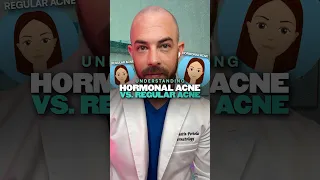 What s the difference between regular and hormonal acne Derm explains