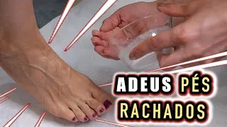 Acabe com as Rachaduras nos Pés e Deixe os Pés Macios com apenas 2 Ingredientes !