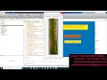Paddy leaf diseases detection using Image processing techniques
