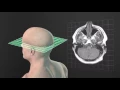 Anatomical Planes Animated Tutorial