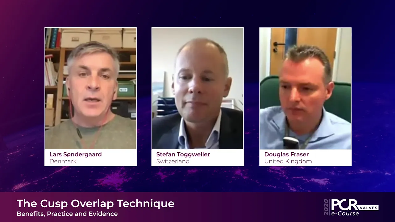 The Cusp Overlap Technique – Benefits, Practice and Evidence - PCR Valves e-Course 2020
