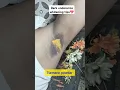 Download Lagu Dark Underarms Whitening at home💖💖#darkunderarmstreatment #darkarmpits #underarmcleaning #armpit
