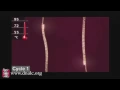 Polymerase Chain Reaction PCR