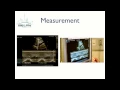 Inferior Vena Cava Ultrasound