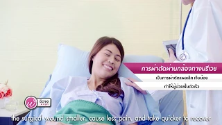 การผ่าตัดผ่านกล้องทางนารีเวช คืออะไร และมีข้อดีอย่างไร