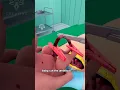 Download Lagu What Really Happens During a C-Section #short #viralvideo - Creativelearning3d