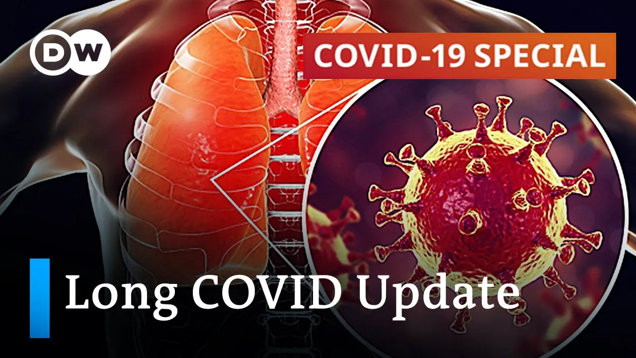 Most infected people, around 80 percent, will have mild symptoms which disappear after a few days. B. 