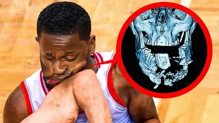 most dangerous injuries in nba 