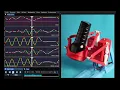 SR6 - Scripted movements