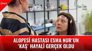 Alopesi hastası Esma Nur'un 'kaş' hayali gerçek oldu