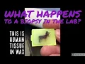 What Happens to Biopsy Samples in the Pathology Lab