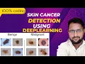 skin cancer detection using deeplearning python