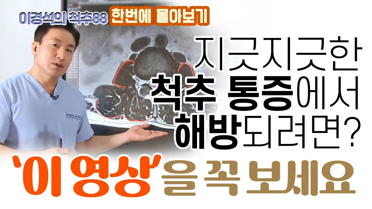 목-허리 통증없이 살려면 ‘이렇게' 하세요! 척추 환자가 알아야 할 모든 것!  - 이경석의 척추88 몰아보기 - 통증관리