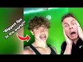The Biggest Lips In The World Orthodontist Reacts