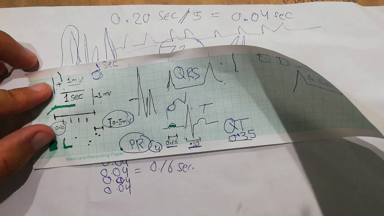 CVS physiology 22. voltage and time calibration of ECG paper, ECG basics, EKG basics