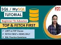 20 - TOP Clause in SQL FETCH FIRST Clause LIMIT vs TOP SQL Practice Query Oracle SQL Server