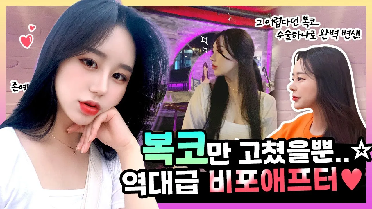 코 성형하고 여신으로 거듭나버렸다?!👋 오똑한 예쁜 코 자랑 좀 하고 갈게요~!🤩