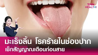 ผู้ป่วยมะเร็งลิ้นควรดูแลตัวเองอย่างไร