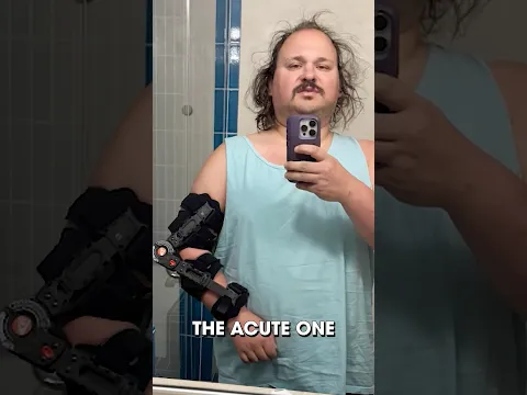 Breaking my elbow #comedy #standup