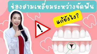 ช่องสามเหลี่ยมระหว่างฟันเกิดจากสาเหตุอะไรบ้าง