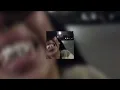 Download Lagu Kodak Black - Love and War (sped up)