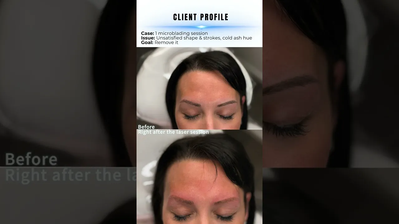 Video from Dasha Cosmetic & Medical Tattoo