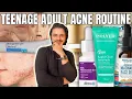 Download Lagu 12,13,14,15,16,17,18,19 Yrs Teenage Acne Routine: Morning \u0026 Night Routine