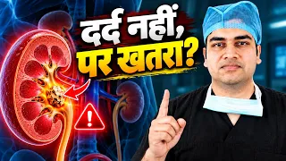 No Pain in Kidney Stone? Why Silent Stones are Dangerous | बिना दर्द की पथरी का सच