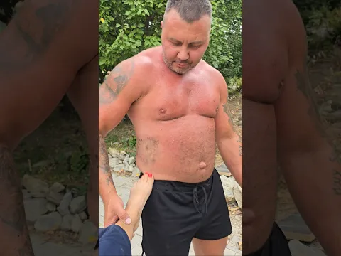 Синяк сделала.