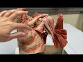 Brachial Plexus Introduction