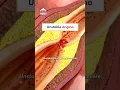 Download Lagu What does my chest pain mean?