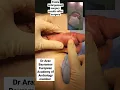 Download Lagu Penile enlargement surgery with excellent results Dr Araz Bayramov www.penilenlargement.com