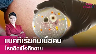 โรคแบคทีเรียกินเนื้อคนสามารถรักษาได้หรือไม่