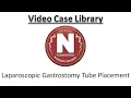 Laparoscopic Gastrostomy Tube Placement