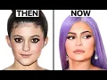 Kylie Jenner s Plastic Surgery - Surgeon Reacts