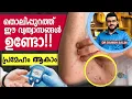 🍯 പ്രമേഹവും ചർമ്മ പ്രശ്നങ്ങളും Diabetes and 10 Skin Diseases