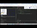 Leetcode 979 Distribute Coins in Binary Tree dfs postorder traversal