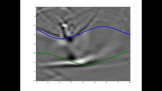 2D Seismic Simulation