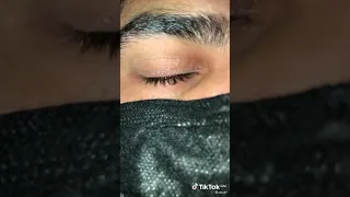 فيديو لعين تسقط منها دموع 