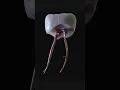 Download Lagu Yg sering sakit gigi biasanya terkendala oleh sel saraf yg terdapat di dlm gigi.  #tooth #biology